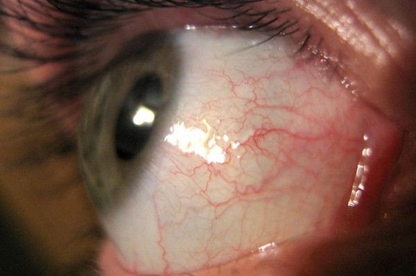 Picture 7 of Species of parasites