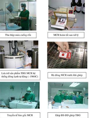 Picture 2 of Stem cell transplantation to treat 40 critical diseases