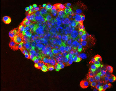 Picture 1 of Stem cells - hope to treat cancer