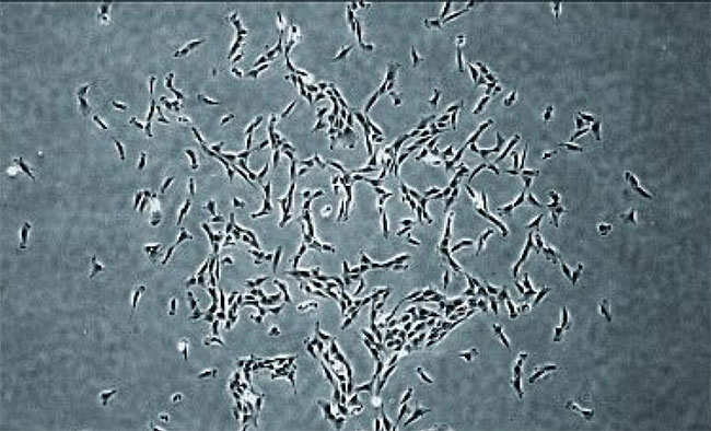 Picture 2 of Stem cells in human bones can renew themselves