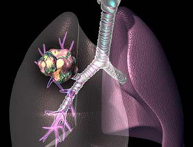 Picture 1 of Stimulates the immune system, cures itself from cancer