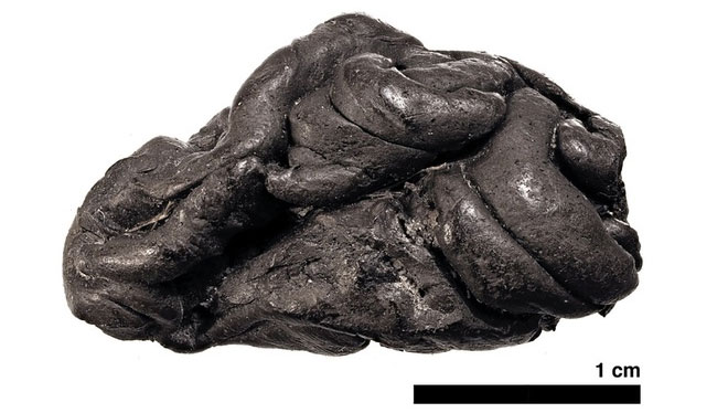 Picture 2 of Stone Age 'chewing gum' reveals the life of a girl who lived 5,700 years ago