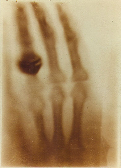 Picture 2 of Stories about scientists find X-rays and radiation