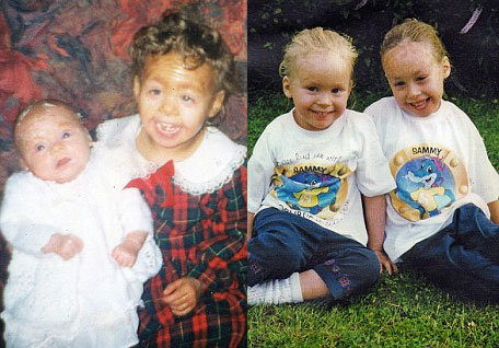 Picture 1 of Strange 2 sisters skinned like a snake
