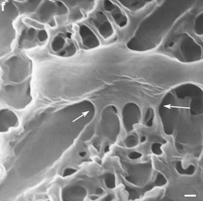 Picture 2 of Strange antibacterial effect of dragonfly wings