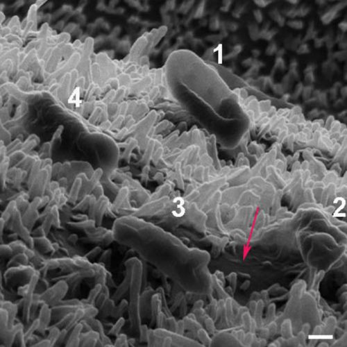 Picture 3 of Strange antibacterial effect of dragonfly wings