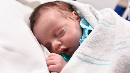 Picture 1 of Strange baby is born twice