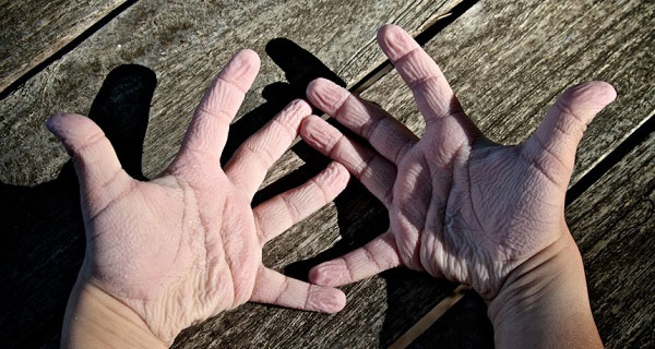 Picture 4 of Strange body reactions make it difficult for you to understand