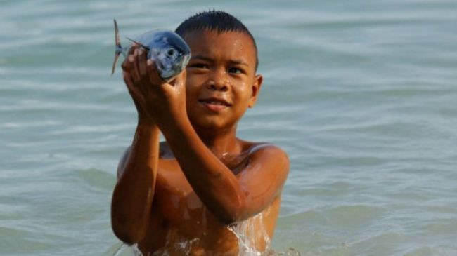 Picture 3 of Strange children have 'dolphin eyes'