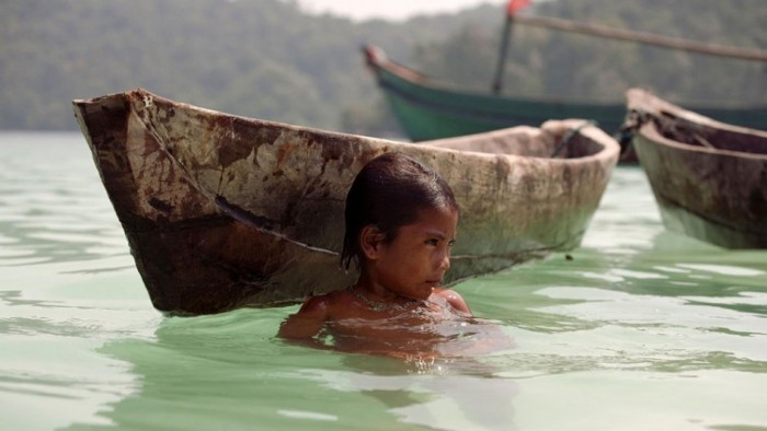 Picture 4 of Strange children have 'dolphin eyes'