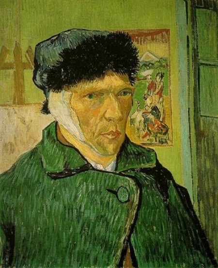 Picture 3 of Strange disease of painting genius