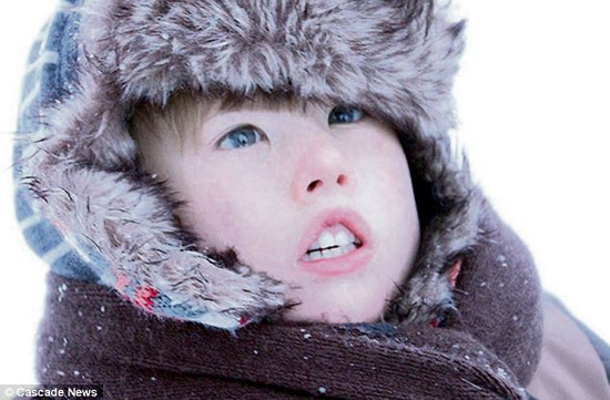 Picture 1 of Strange disease: The boy has a face