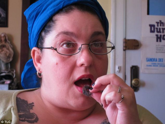 Picture 1 of Strange disease: Woman addicted to cat fur eating