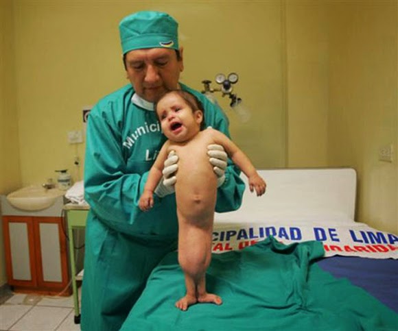 Picture 3 of Strange diseases