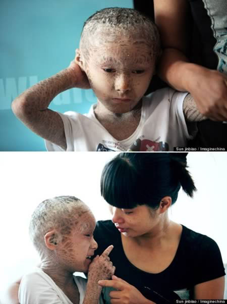 Picture 1 of Strange diseases that make medicine 'bundle of hands'
