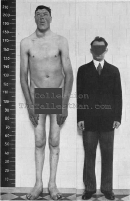 Picture 4 of Strange diseases that make medicine 'bundle of hands'