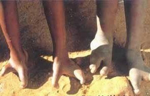 Picture 5 of Strange feet in the world