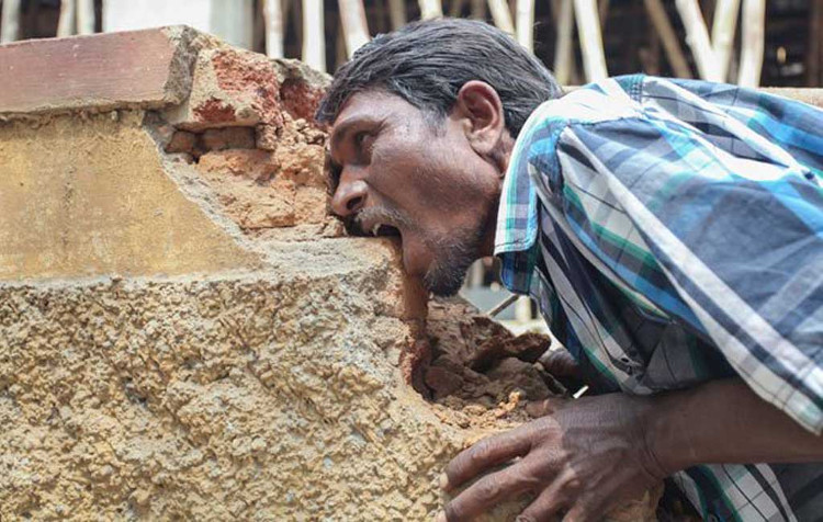 Picture 1 of Strange healing ways of Stone Age people