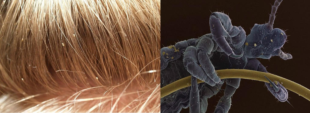 Picture 14 of Strange images of ordinary objects are viewed through a microscope