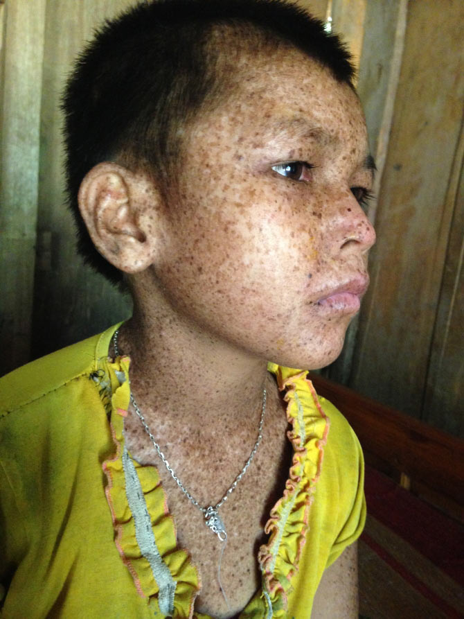 Picture 2 of Strange life-threatening disease of people in Phu Tho