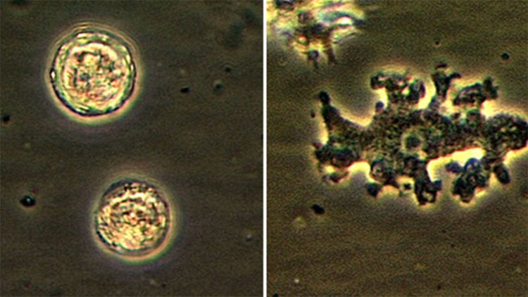 Picture 1 of Strange patients in the US have brain eating amoeba while still ... living
