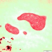 Picture 1 of Strange proteins of organisms like harsh environments