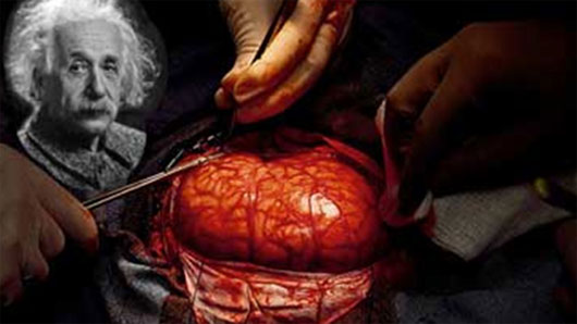 Picture 1 of Strange stories are true about the human brain