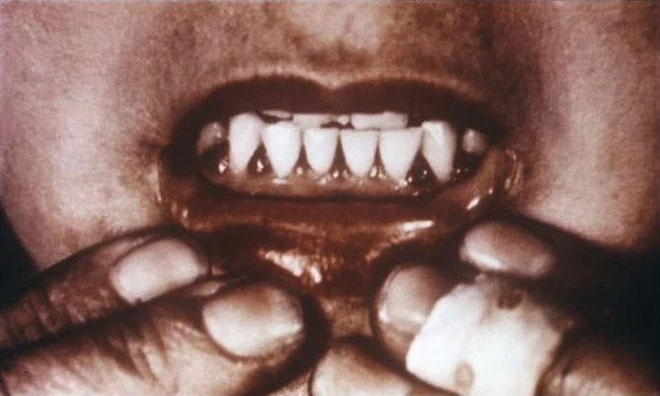 Picture 3 of Strange story in Antarctica, eating animal liver can lead to death