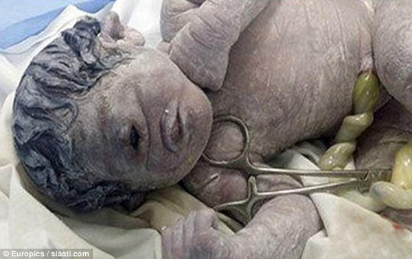 Picture 1 of Strange story: The one-eyed boy was born in Egypt