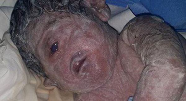 Picture 2 of Strange story: The one-eyed boy was born in Egypt