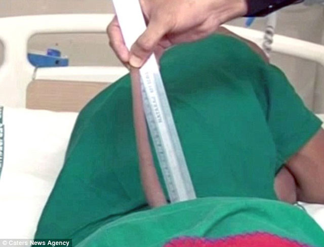 Picture 1 of Strange story: The young male survives the tail about 18cm long