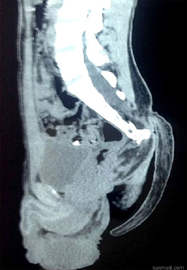 Picture 2 of Strange story: The young male survives the tail about 18cm long
