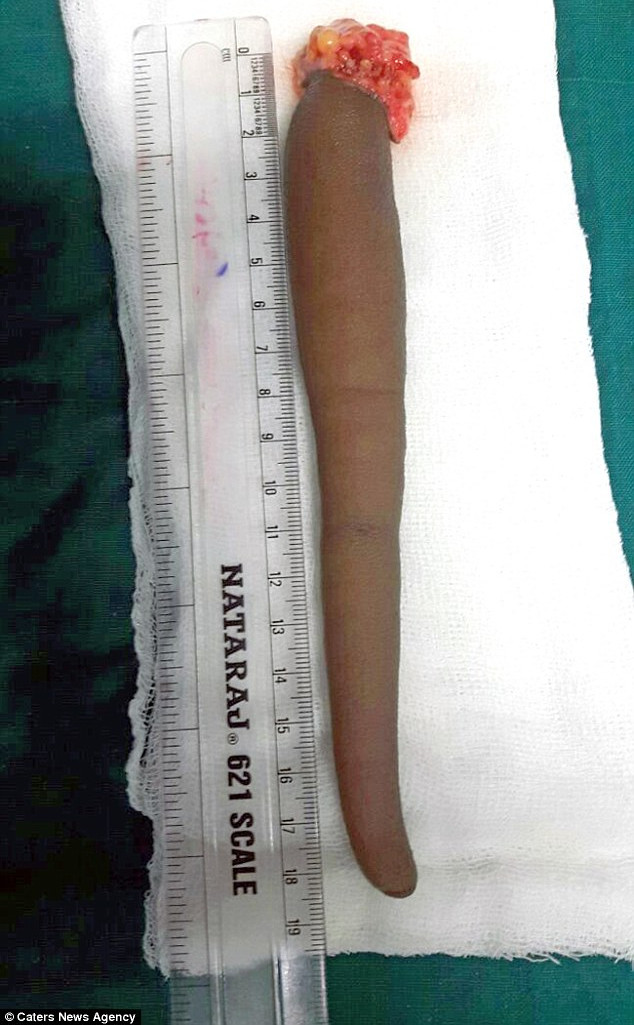 Picture 3 of Strange story: The young male survives the tail about 18cm long