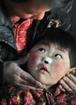 Picture 2 of Strange, the baby girl naturally lost her nose