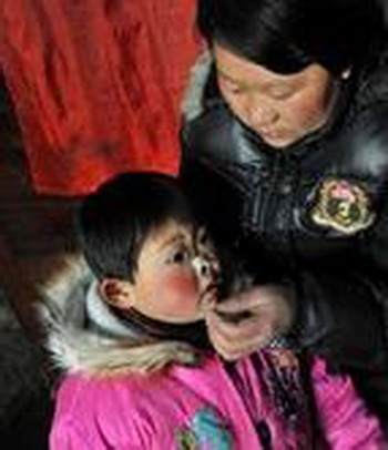 Picture 4 of Strange, the baby girl naturally lost her nose