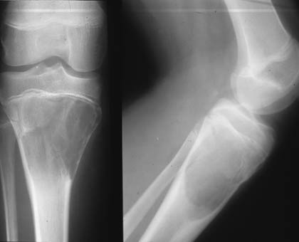 Picture 3 of Strange things about the body