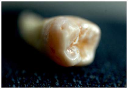 Picture 5 of Strange things about the body