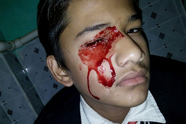 Picture 1 of Strangely the man 'cried blood' continuously for ... 1 hour