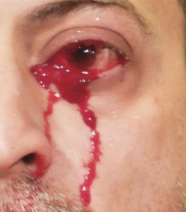 Picture 2 of Strangely the man 'cried blood' continuously for ... 1 hour