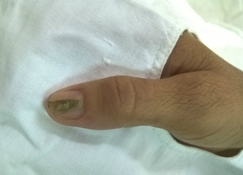 Picture 1 of Striped nails watch out for the coil