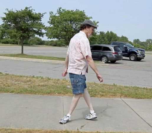 Picture 1 of Stunned with a man who broke his leg 180 degrees, he could still walk normally