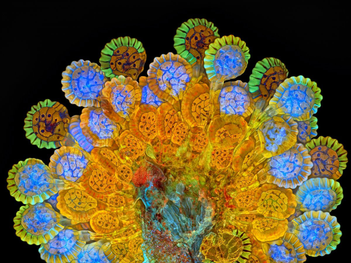Picture 11 of Stunning photos taken under a microscope won the Nikon Small World 2015