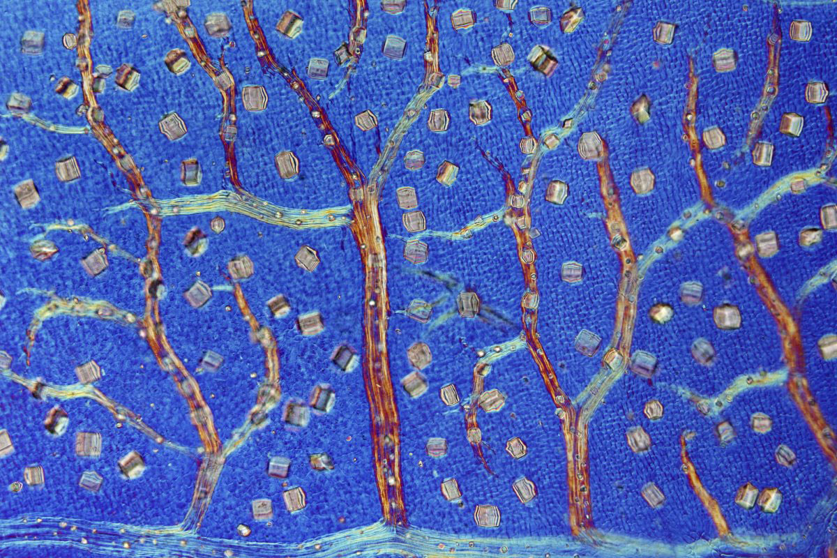 Picture 17 of Stunning photos taken under a microscope won the Nikon Small World 2015