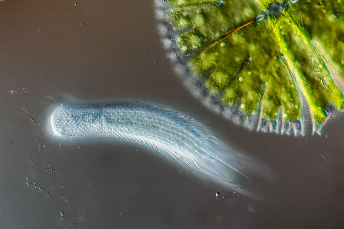 Picture 18 of Stunning photos taken under a microscope won the Nikon Small World 2015