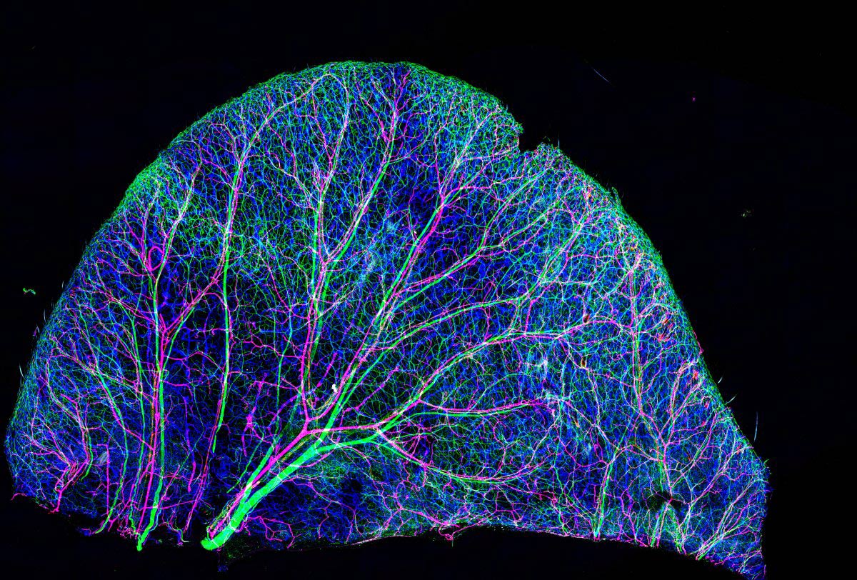 Picture 8 of Stunning photos taken under a microscope won the Nikon Small World 2015