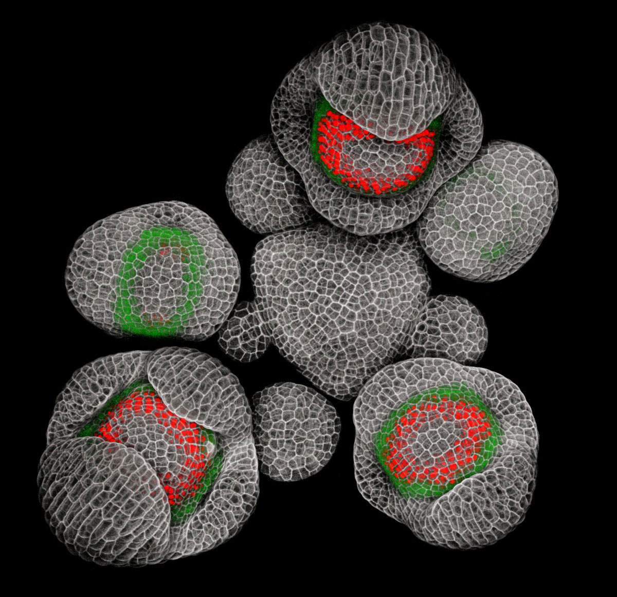 Picture 9 of Stunning photos taken under a microscope won the Nikon Small World 2015