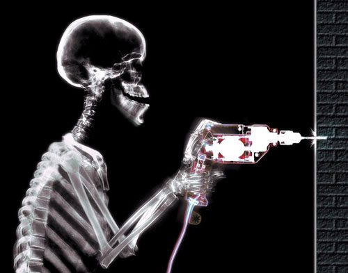 Picture 5 of Stunning photos taken with X-rays