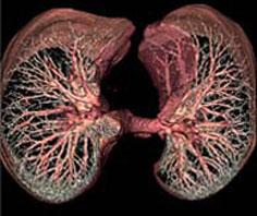 Picture 1 of Successful application of lung washing technology