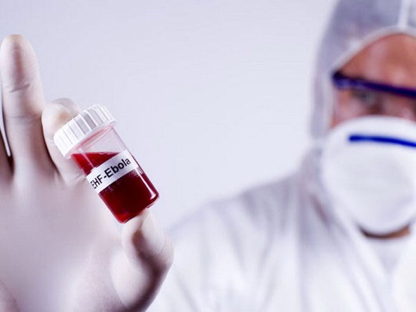 Picture 1 of Successful development of antibodies that treat Ebola