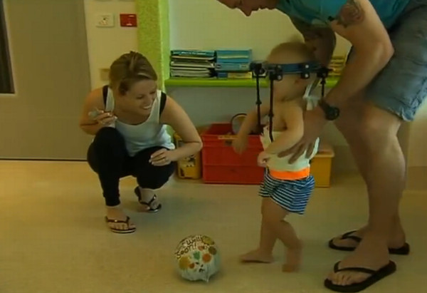 Picture 3 of Successful head transplant surgery for one-year-old boys